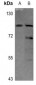 Anti-Matriptase Antibody