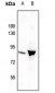 Anti-STAT3 (pY705) Antibody