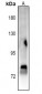 Anti-STAT4 (pY693) Antibody