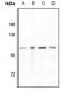 Anti-STAT6 (pY641) Antibody