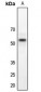 Anti-LKB1 Antibody