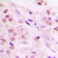 Anti-TCEB3 Antibody