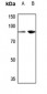 Anti-TCEB3 Antibody