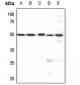 Anti-AP2 gamma Antibody