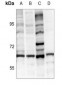 Anti-Tyrosine Hydroxylase Antibody