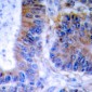 Anti-TNFAIP1 Antibody