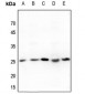 Anti-Translin Antibody