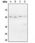 Anti-VASP (pS157) Antibody