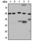 Anti-GALR2 Antibody