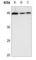 Anti-GDF15 Antibody