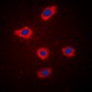 Anti-MELK Antibody