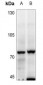 Anti-MELK Antibody