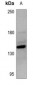 Anti-ZEB2 Antibody