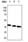 Anti-ACOT8 Antibody