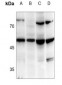 Anti-TANK Antibody