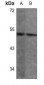 Anti-ANGPTL7 Antibody