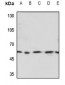 Anti-TESK2 Antibody