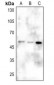 Anti-CD2BP2 Antibody