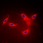 Anti-LYPLA1 Antibody