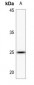 Anti-LYPLA1 Antibody
