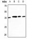 Anti-CDC42EP2 Antibody