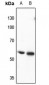 Anti-CRMP3 Antibody