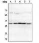 Anti-14-3-3 theta/tau Antibody