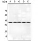 Anti-14-3-3 theta Antibody