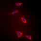 Anti-FATP5 Antibody