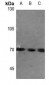 Anti-FATP5 Antibody