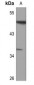 Anti-ATF7 Antibody