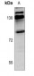 Anti-Kanadaptin Antibody