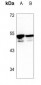 Anti-CDKL3 Antibody