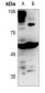 Anti-BAIAP2L1 Antibody