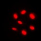 Anti-BAF250B Antibody