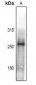 Anti-BAF250B Antibody