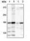 Anti-HECW2 Antibody