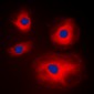 Anti-MRPL11 Antibody