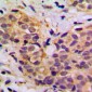 Anti-MRPL11 Antibody