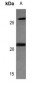 Anti-MRPL11 Antibody