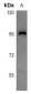 Anti-CHSY2 Antibody