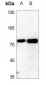 Anti-ITPKC Antibody
