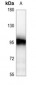 Anti-ATRIP Antibody