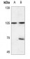 Anti-EEF2K (pS366) Antibody