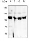 Anti-Factor B Antibody