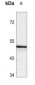 Anti-ANGPTL3 Antibody