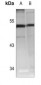 Anti-Cathepsin A 20k Antibody