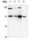 Anti-Cathepsin C LC Antibody