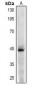 Anti-CD123 Antibody