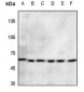 Anti-CD156a Antibody